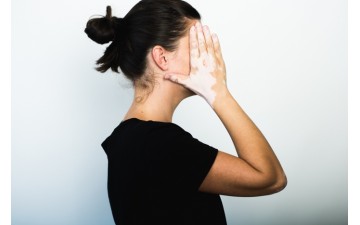 Первые признаки витилиго: симптомы у детей и взрослых